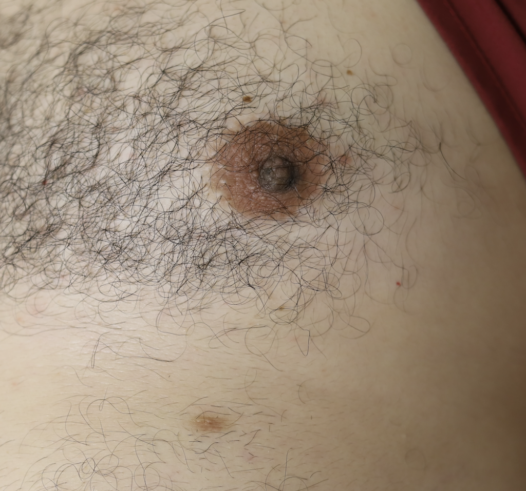 male accessory nipple
